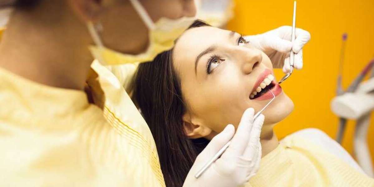 Veneers: A Complete Guide to Transforming Your Smile