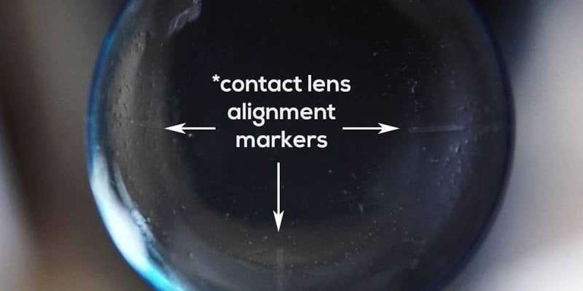 What You Need to Know About Contact Lenses ?