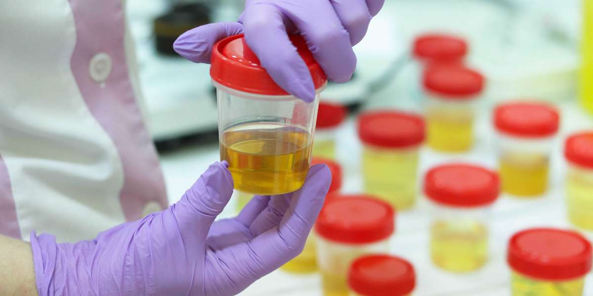 Urinalysis Market Expected to Witness a Sustainable Growth over 2031
