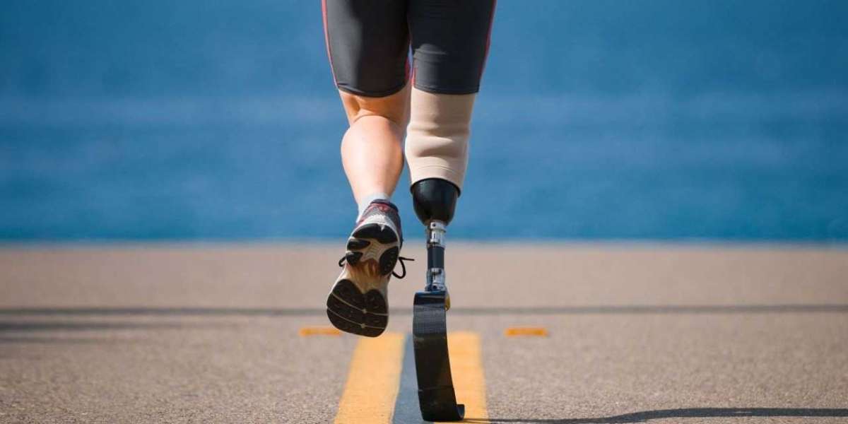 Orthopedic Prosthetics: Innovations Transforming the Landscape of Ortho Prosthetics A New Lease of Life