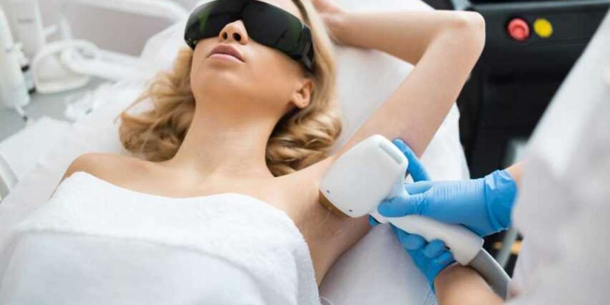 The Complete Guide to Laser Hair Removal: What You Need to Know