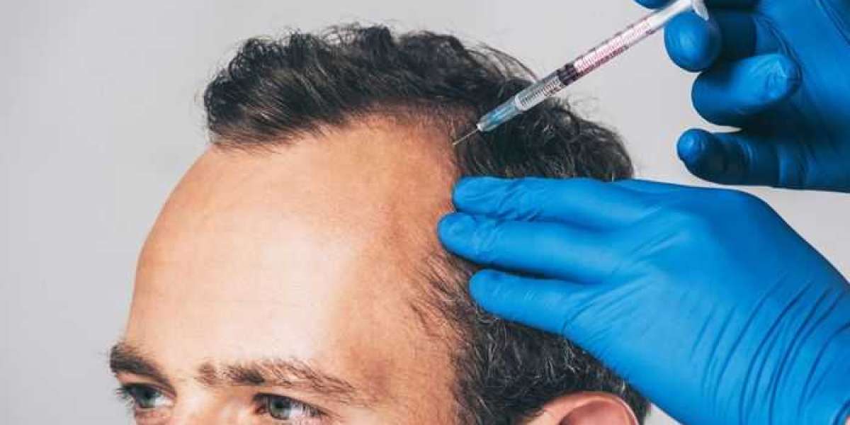 How to Choose the Best PRP Hair Treatment Clinic in Dubai