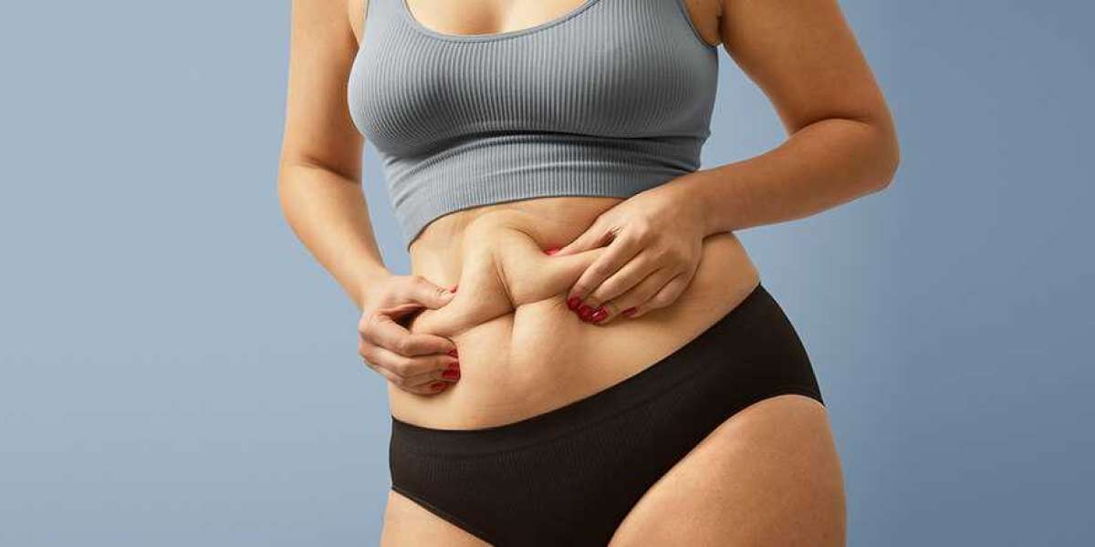 Abdominoplasty Cost: Exploring Medical Tourism Services