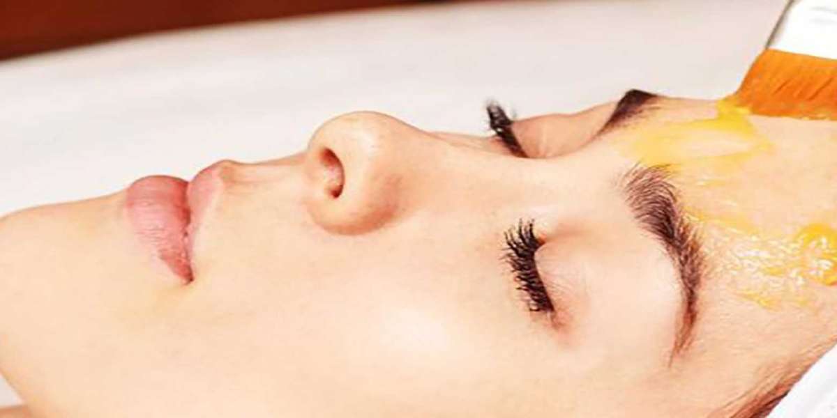 Delhi's Guide to Perfect Skin: Everything You Need to Know About Chemical Peels