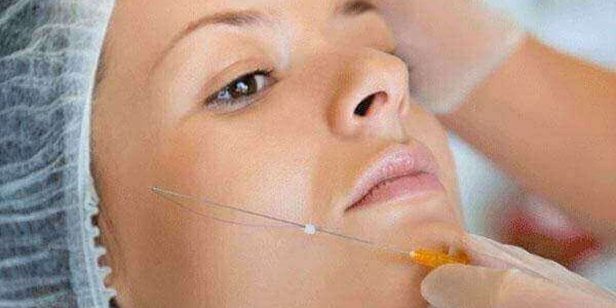 Where Can You Find Thread Lift Treatment Dubai?