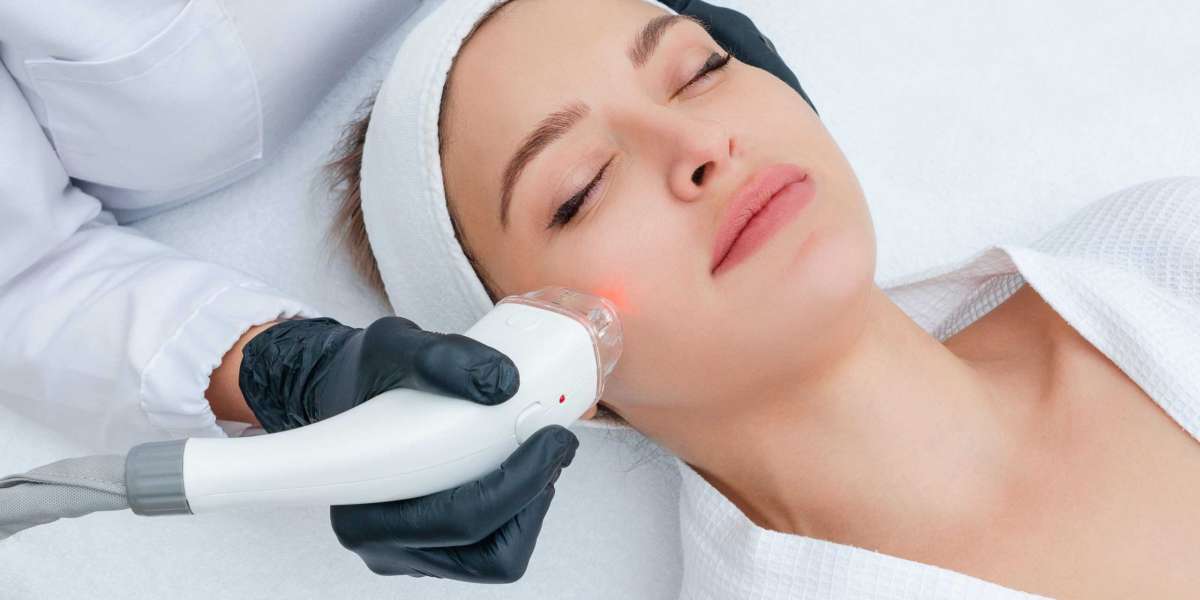 Fractional CO2 Laser Treatment: Cost vs. Results in Dubai