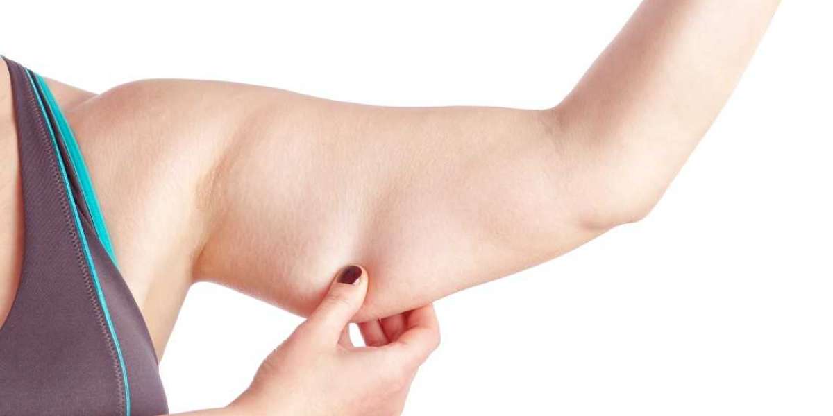 Boost Your Self-Esteem with Arm Lift Surgery