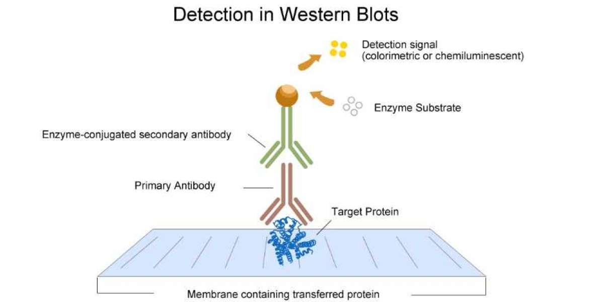 Western Blotting: A Powerful Technique for Protein Analysis