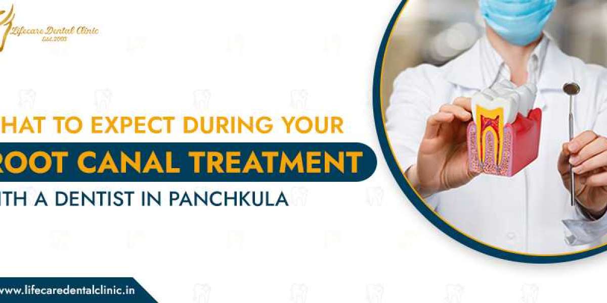 What to expect during your Root Canal Treatment with a Dentist in Panchkula