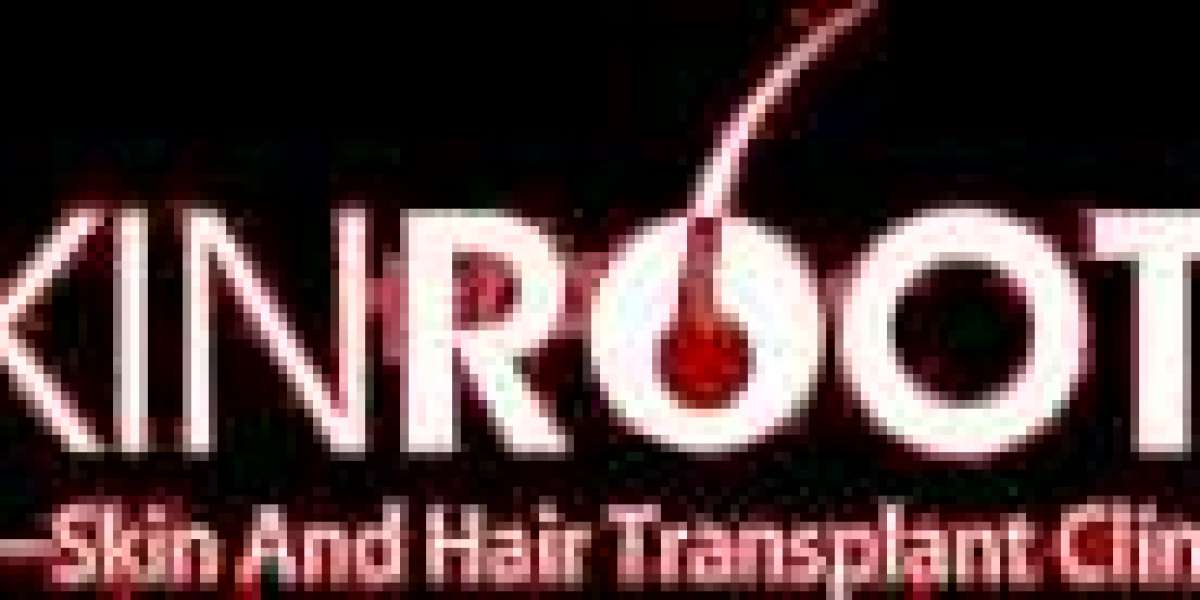 Hair transplant cost in Delhi