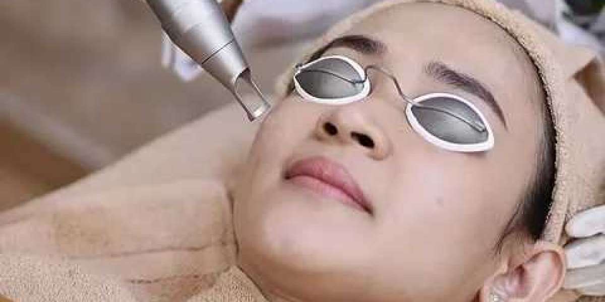 Fractional CO2 Lasers for Youthful Skin in Dubai