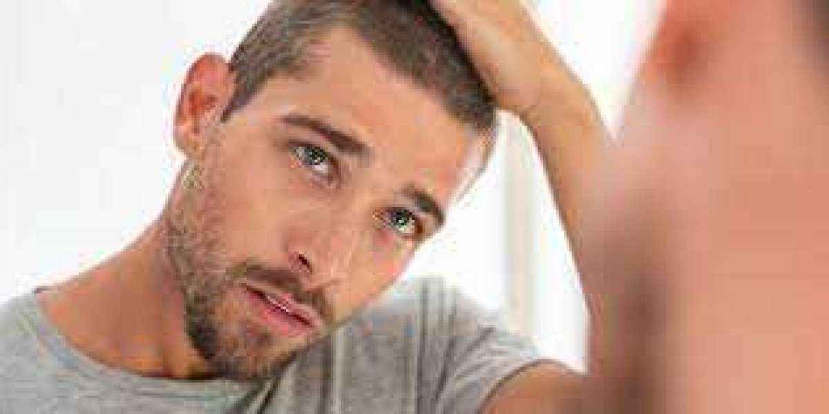 PRP for Hair Loss: How Effective Is It in Dubai UAE