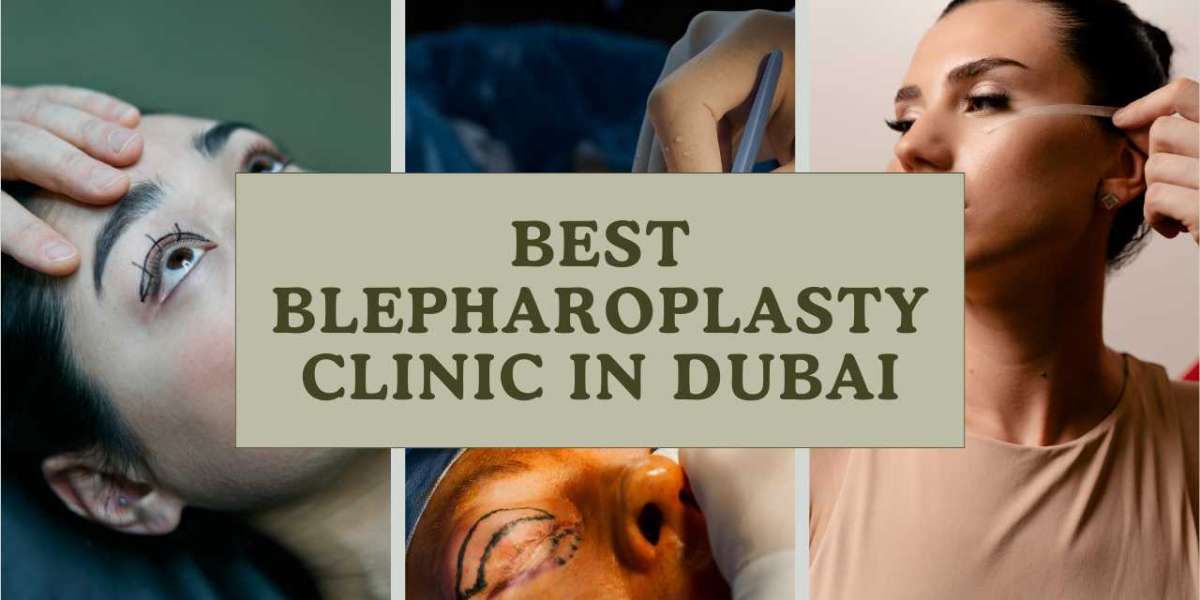 Best blepharoplasty clinic in Dubai