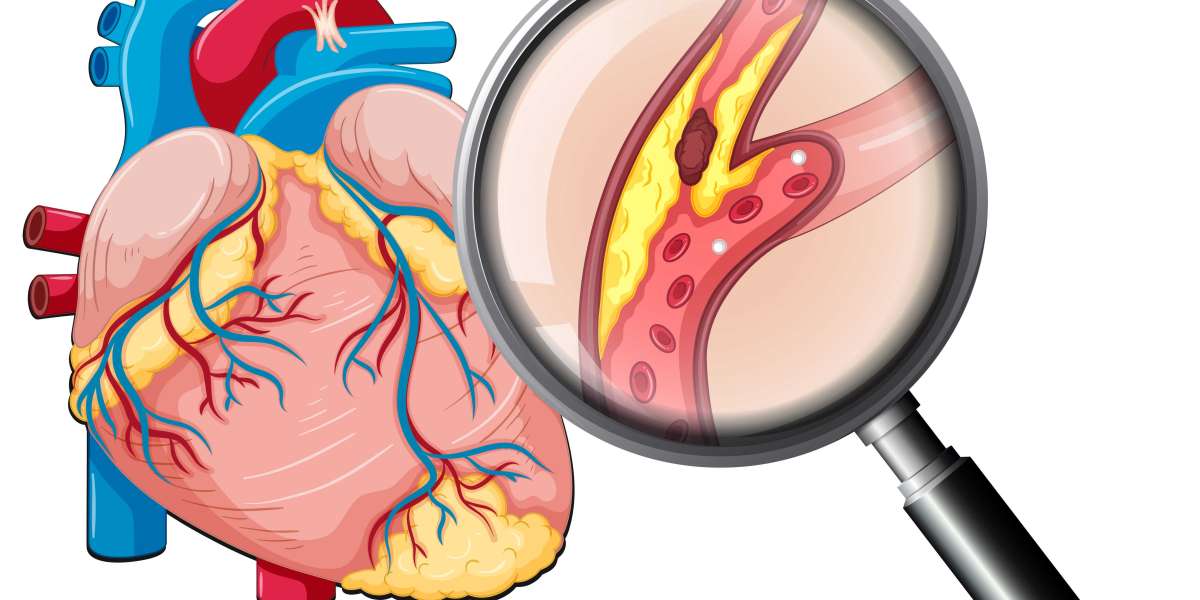 A Guide to Heart Tumor Treatment Options in India