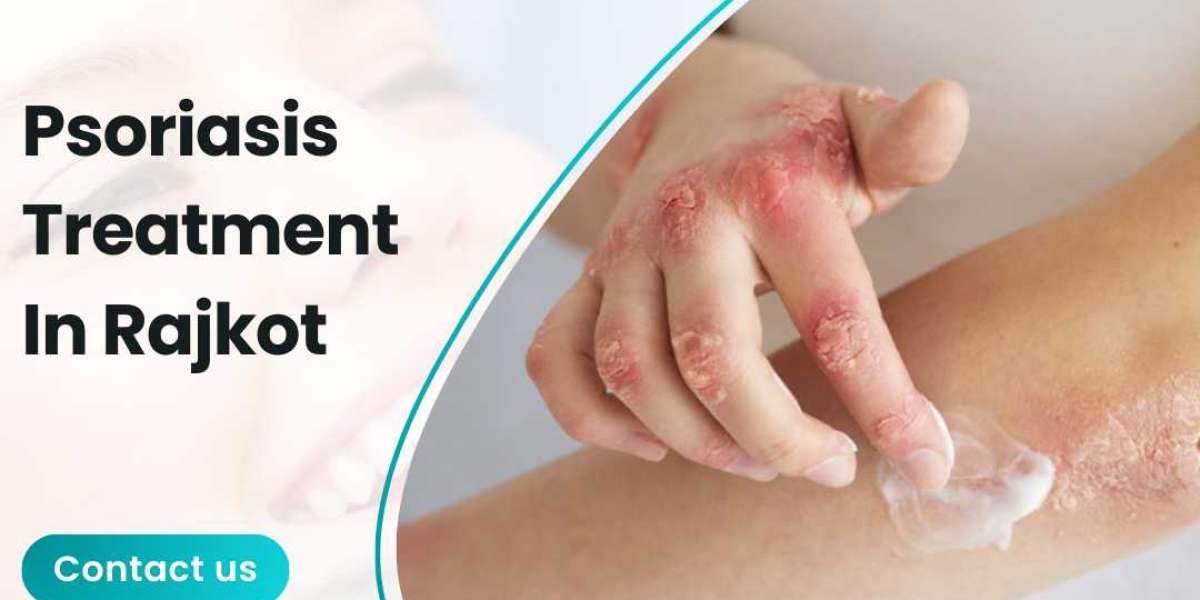 Psoriasis Treatment In Rajkot: Discover Holistic Healing with Vaidya Yogesh Vani