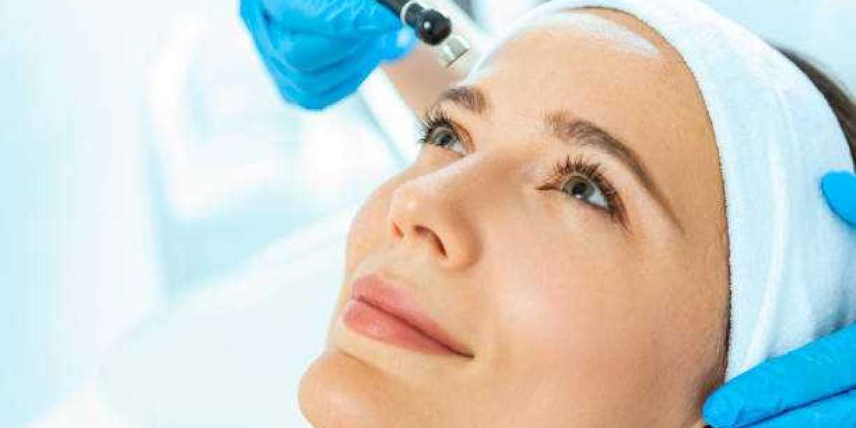 Benefits of SkinPen Microneedling for Flawless Skin