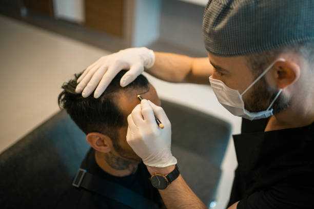 تكلفة زراعة الشعر 