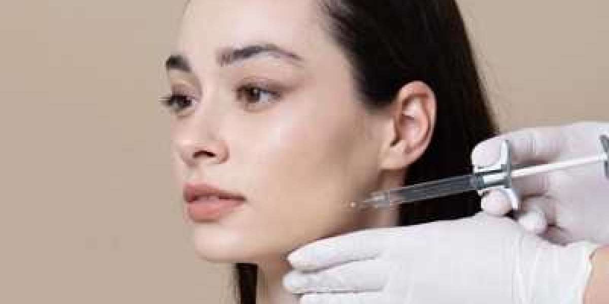 Aesthefill Injection for Nasolabial Folds: A Non-Surgical Solution in Muscat