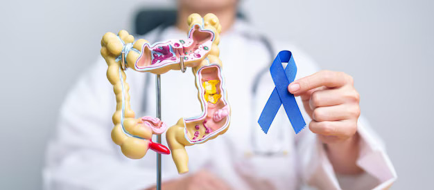 Colon Cancer: Stages, Symptoms & Treatment Techniques - vehicle information and reviews