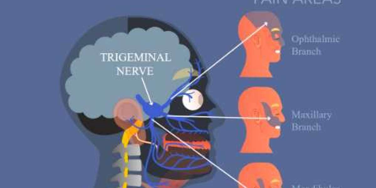 TMJ-Related Headache Treatment in Tardeo