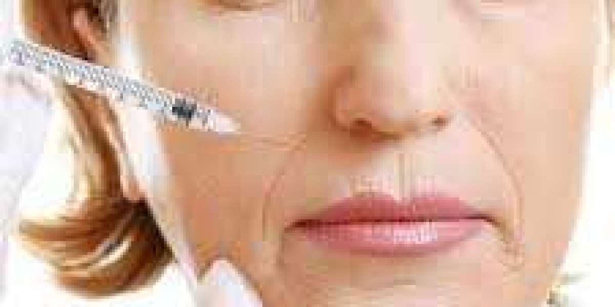 Banish Wrinkles and Revitalize Your Look at Riyadh’s Botox Clinics