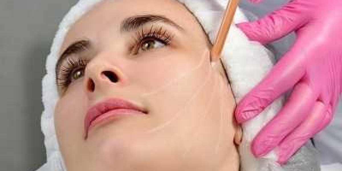 Enhance Facial Contours with Thread Lifts