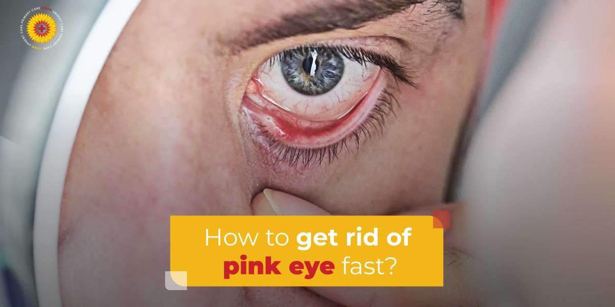 How to Get Rid of Pink Eye Fast?