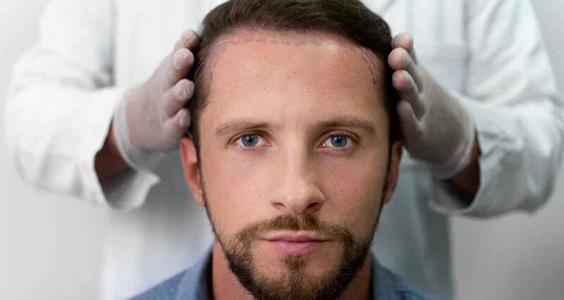 Hair Transplant in Dubai