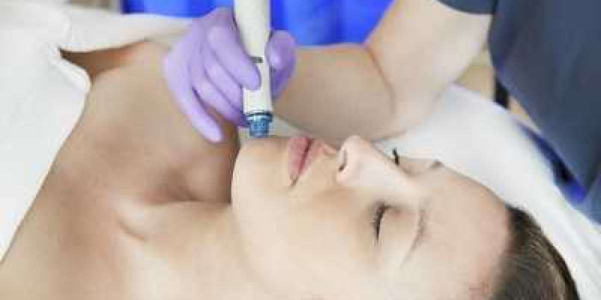 How HydraFacial Improves Skin Tone and Texture: A Step-by-Step Guide