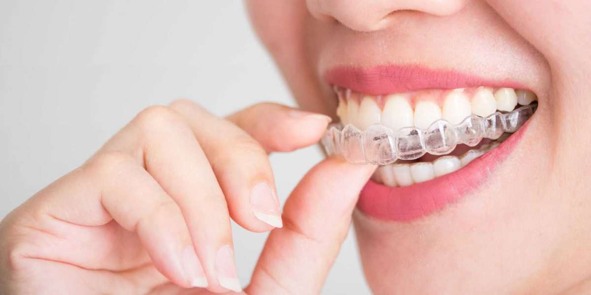 Trouvez le Meilleur Spécialiste en Orthodontie Près de Chez Vous Aujourd'hui