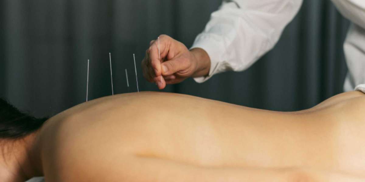 Acupuncture for Chronic Back Pain: A Natural Solution for Lasting Relief