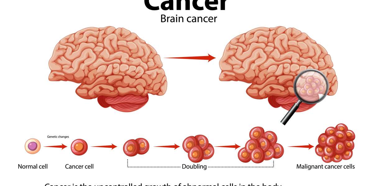 Brain Tumor Treatment in India