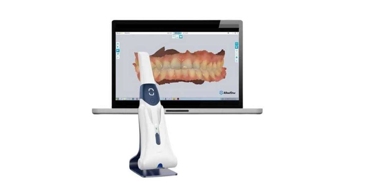 Cheapest (but Quality) Intraoral Scanners for 2025