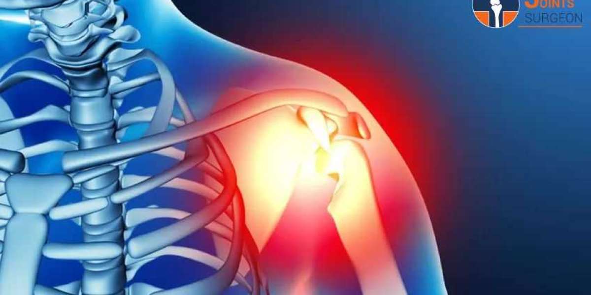 Comprehensive Shoulder Care: Expert Shoulder Replacement Surgeon