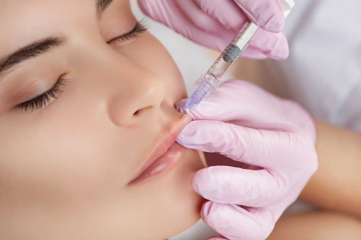 dermal fillers in Dubai