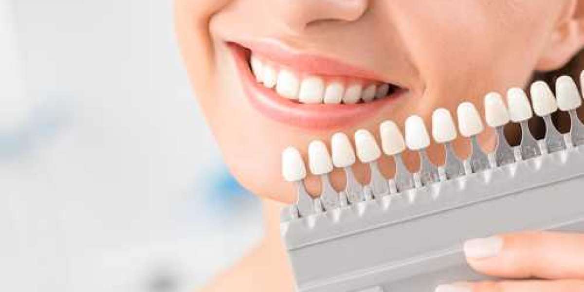 Why Regular Dental Check-Ups Are Important for Your Health