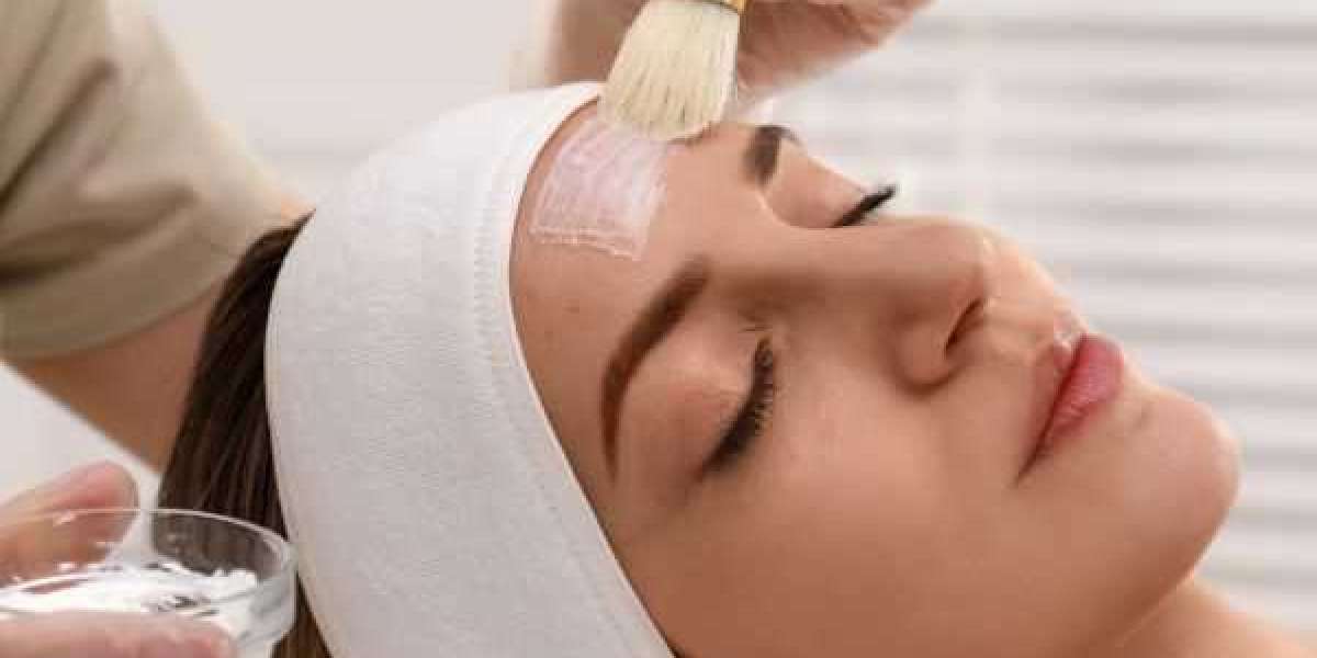 Reducing Fine Lines and Wrinkles with Chemical Peels