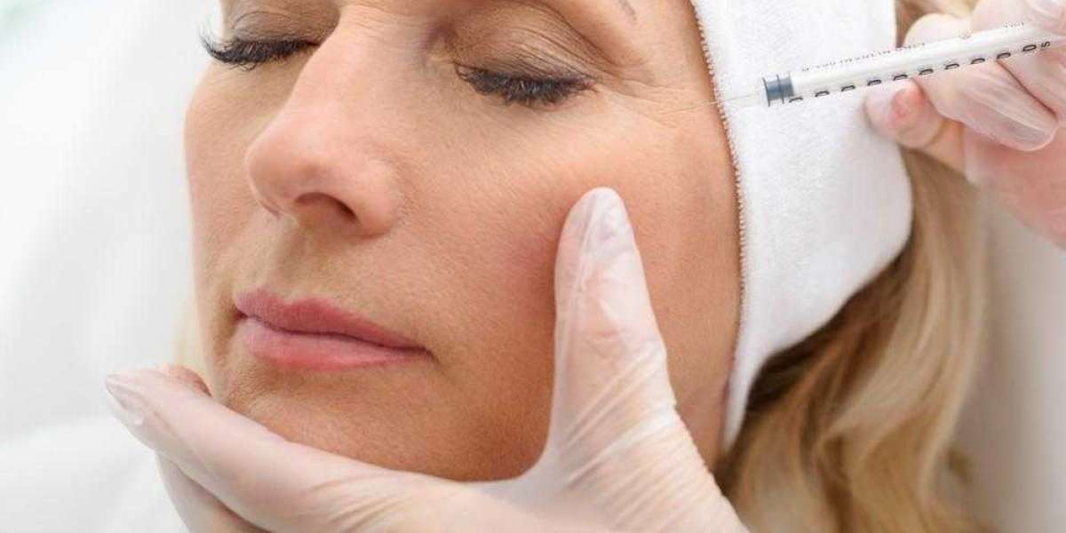 Botox for Crow's Feet: Does It Work?