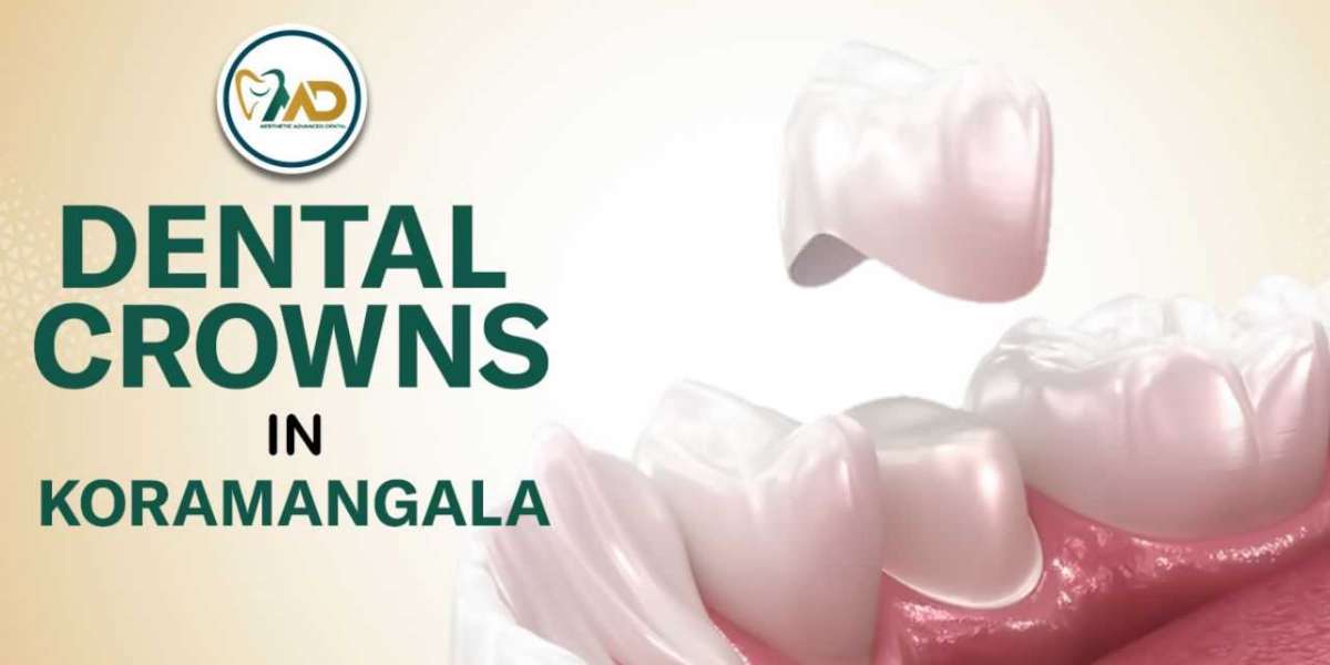 Expert Dental Care with Dental Crowns in Koramangala