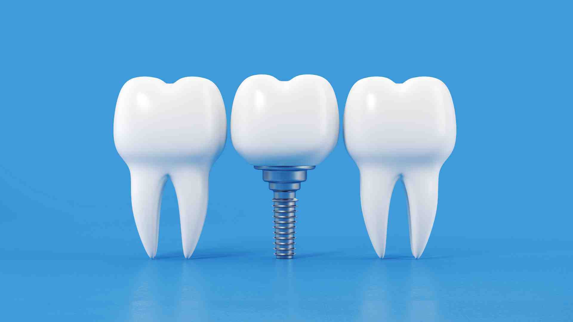 The Secret Behind Painless Dental Implants