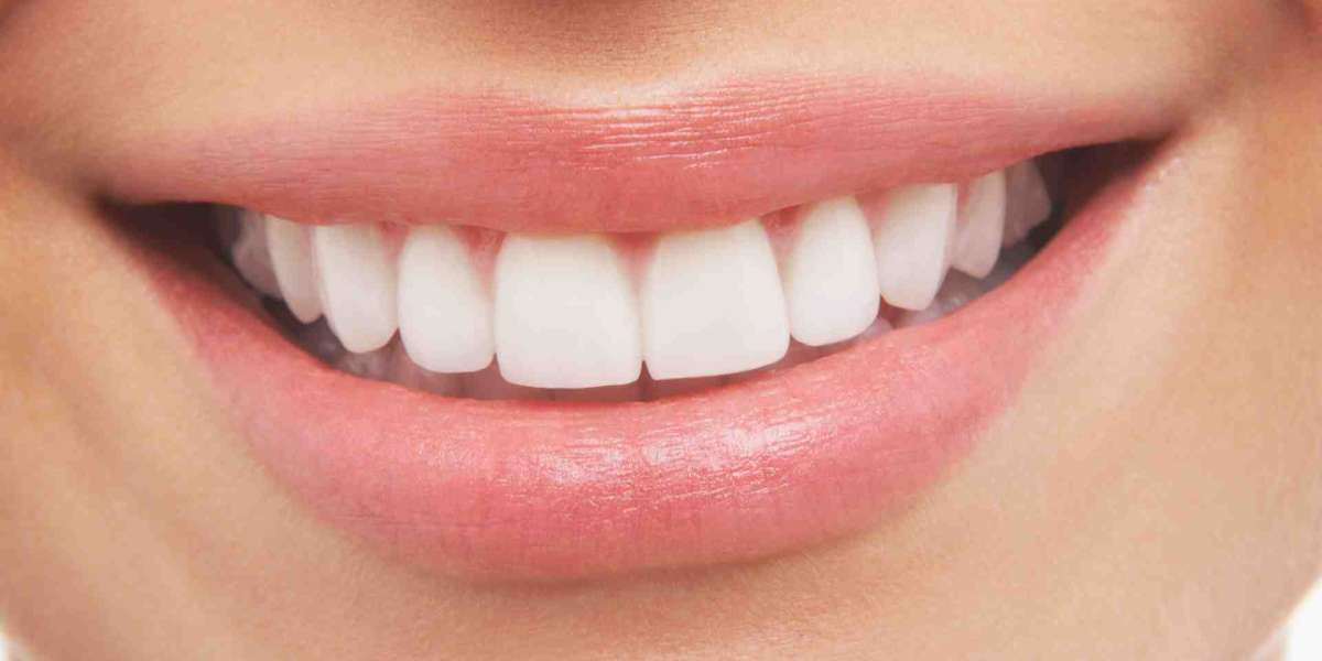 Teeth Alignment: Exploring the Best Options for a Perfect Smile