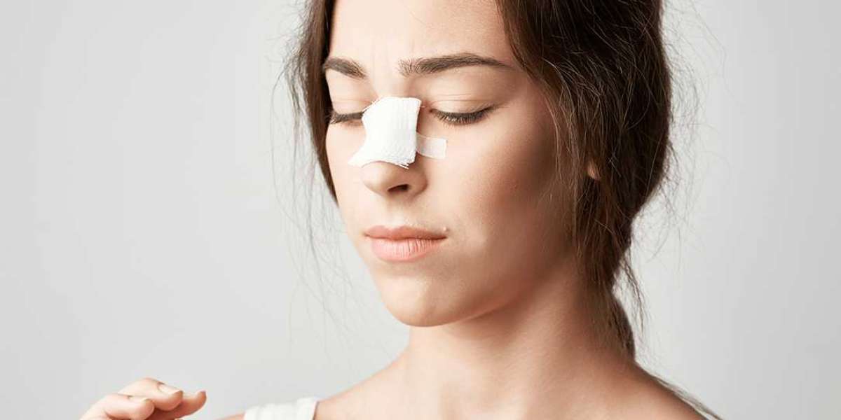 Expert Insights on Rhinoplasty Dubai Trends