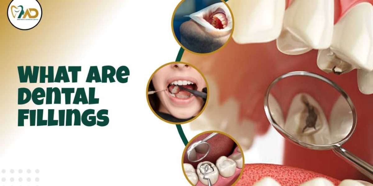 Dental Fillings Made Easy: Advantages and What Follows