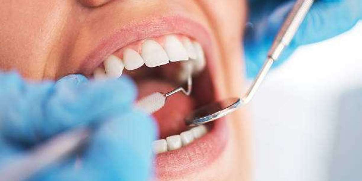 The Role of a Dentist in Preventing and Treating Cavities