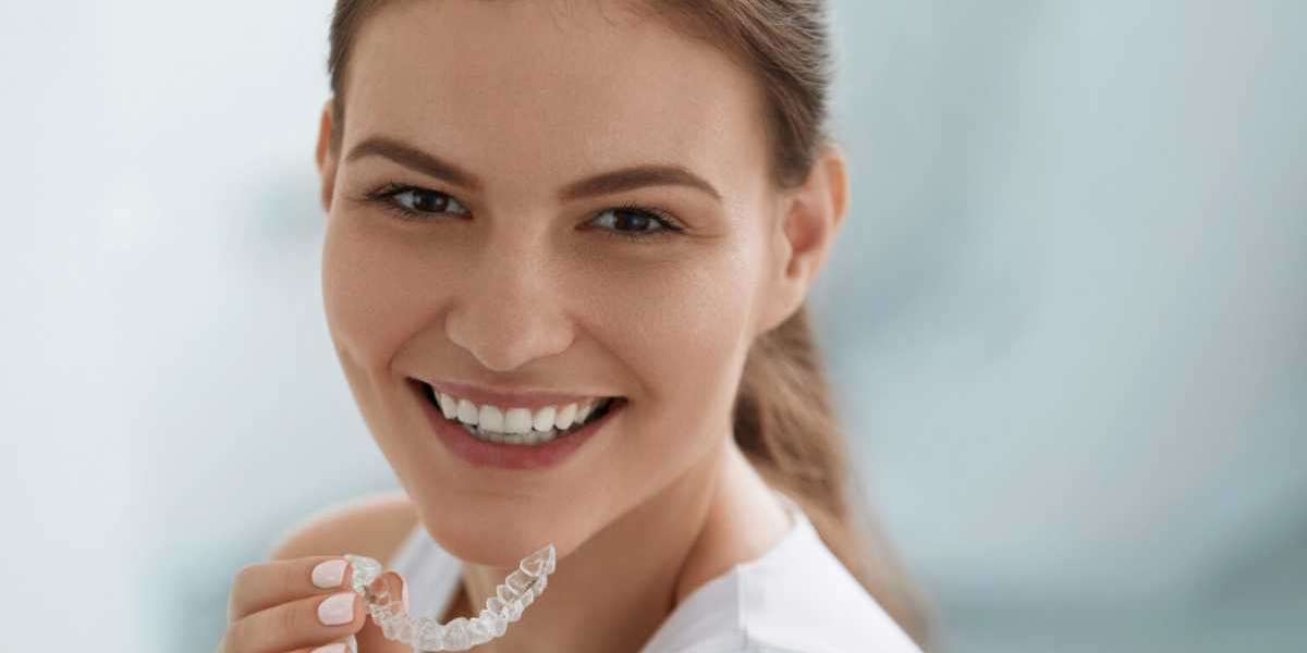 Braces in Geneva: What You Need to Know