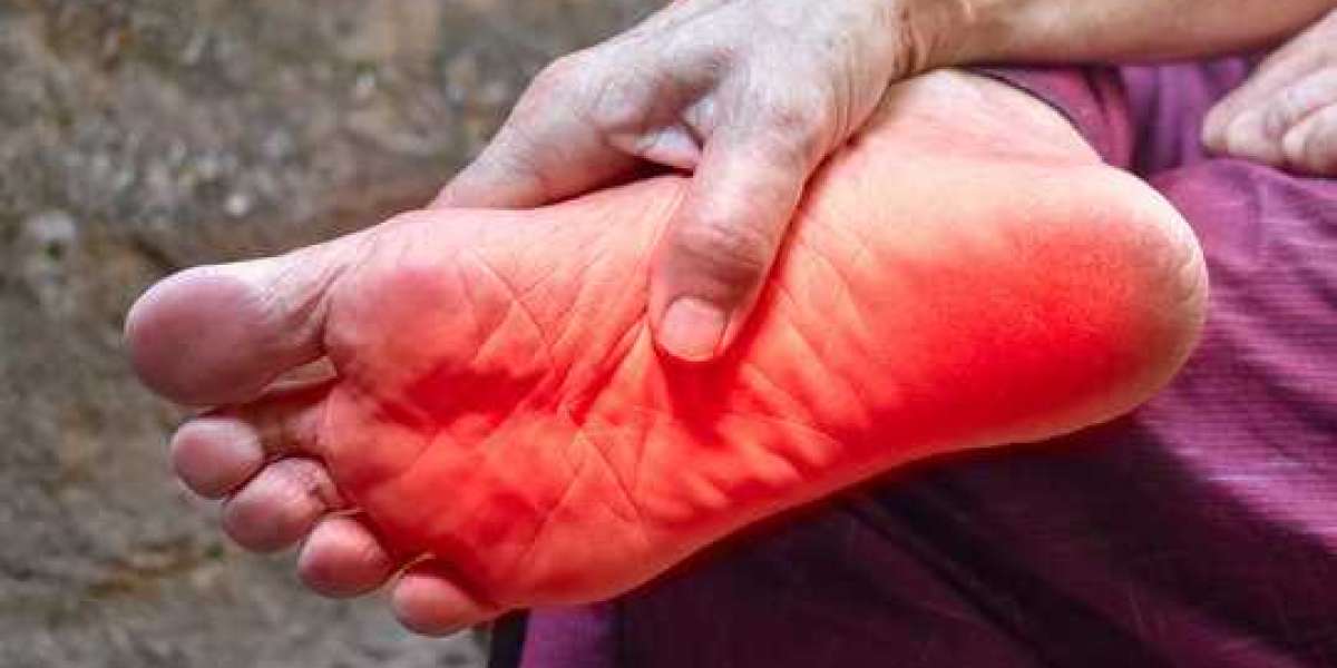 Erythromelalgia Treatment Options for Managing Pain Symptoms