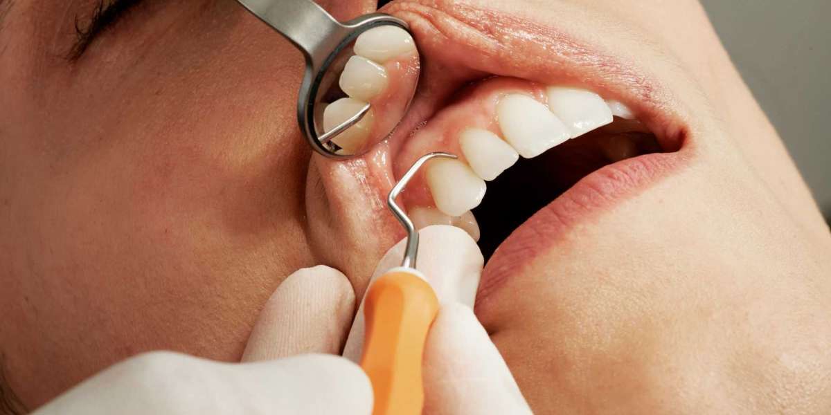 Emergency Dental Care in Franklin and Gungahlin