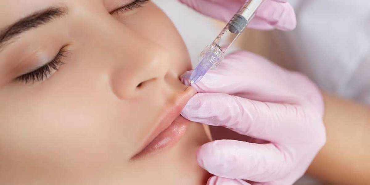 Lip Filler: A Comprehensive Guide to Enhancing Your Smile