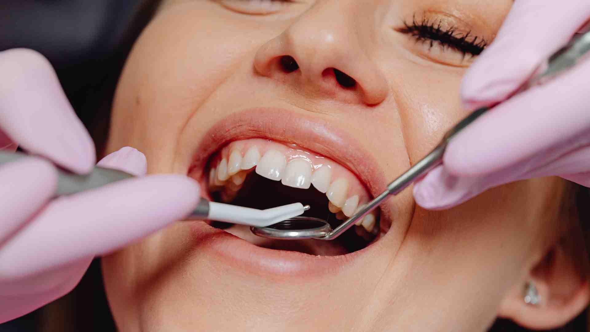 Why Dubai Is the Ideal Place for Dental Treatments