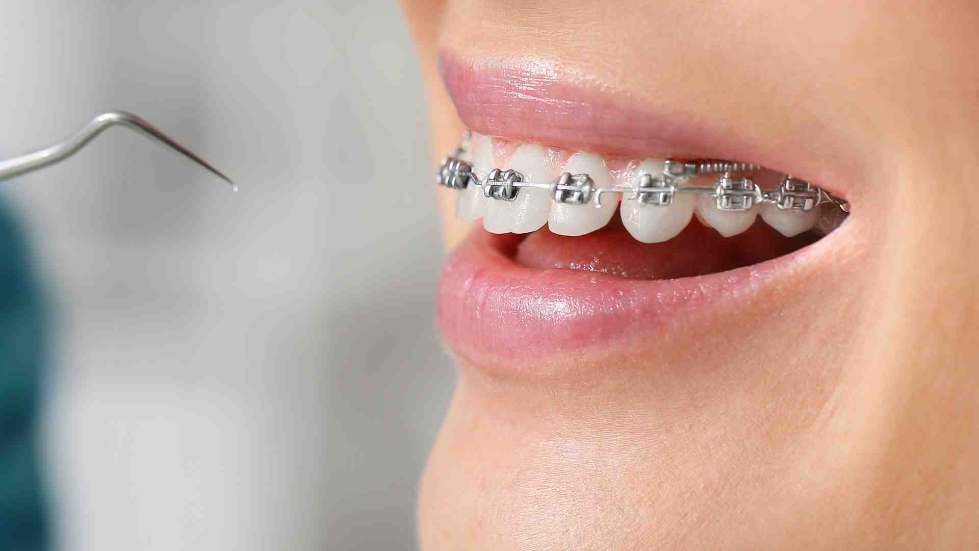 Why Should You Consider Orthodontics Today?